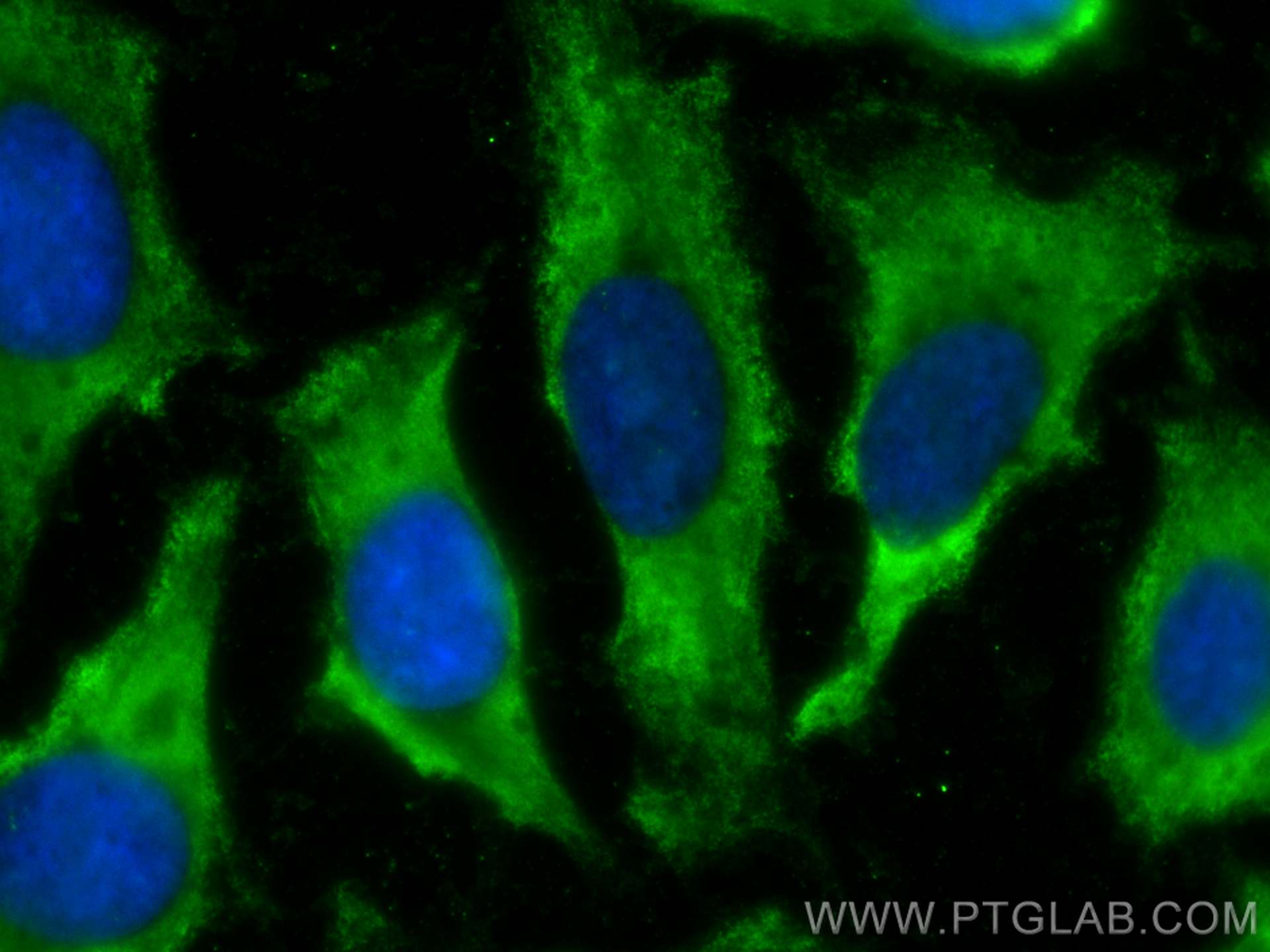 IF Staining of HeLa using CL488-68330