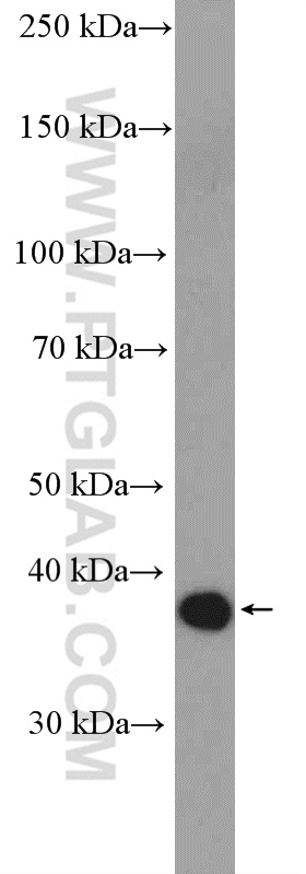 WB analysis of mouse spleen using 11627-1-AP