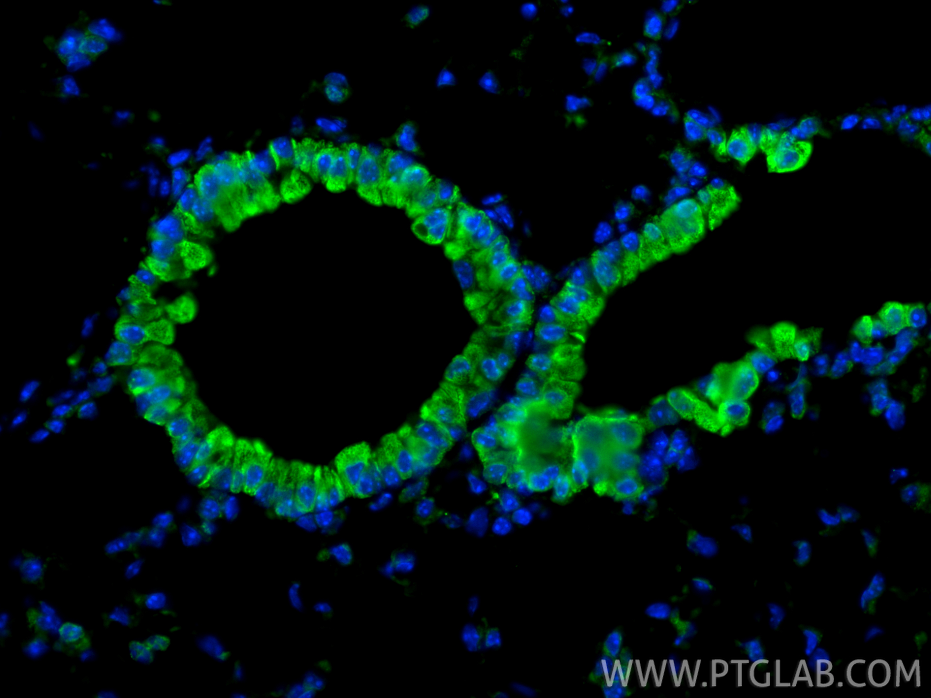 Immunofluorescent analysis of (4% PFA) fixed paraffin-embedded mouse lung tissue using EPX antibody (29755-1-AP) at dilution of 1:200 and CoraLite®488-Conjugated Goat Anti-Rabbit IgG(H+L) (<a class='green' href='/productredirect?CatalogNo=SA00013-2' target='_blank'>SA00013-2</a>). Heat mediated antigen retrieval with Tris-EDTA buffer (pH 9.0). IF Staining of mouse lung using 29755-1-AP