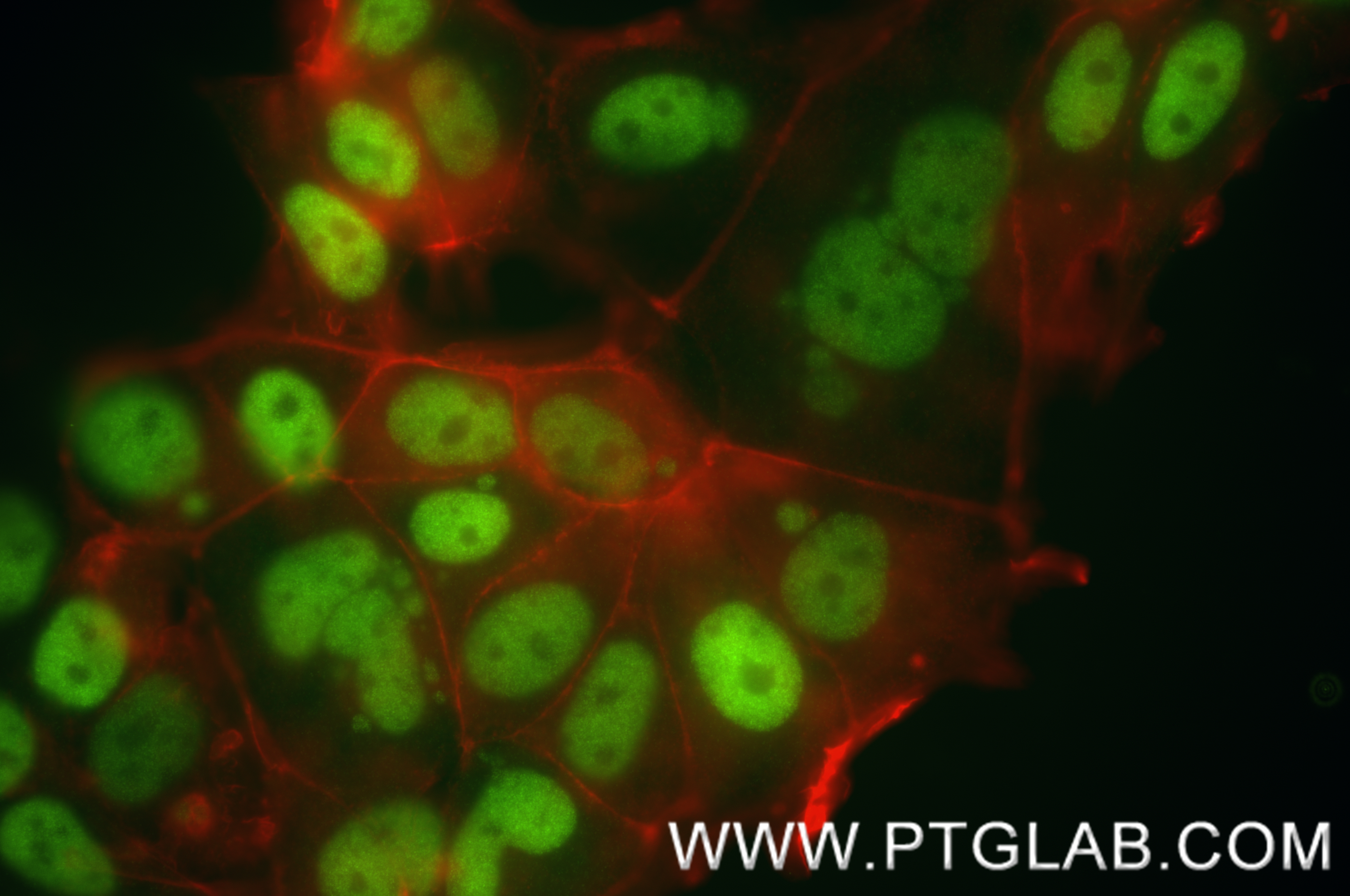 IF Staining of MCF-7 using 84564-4-RR