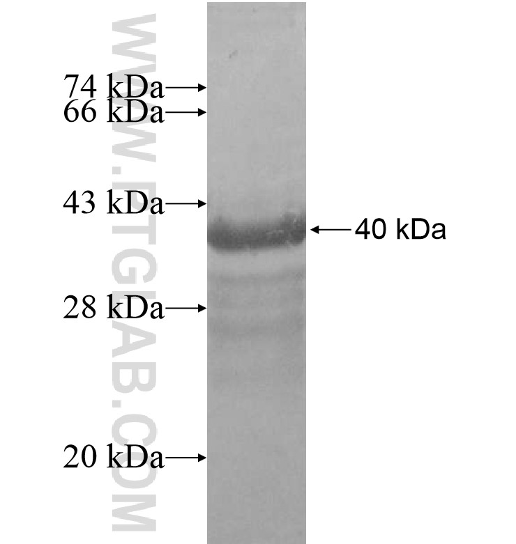 ER81 fusion protein Ag16172 SDS-PAGE