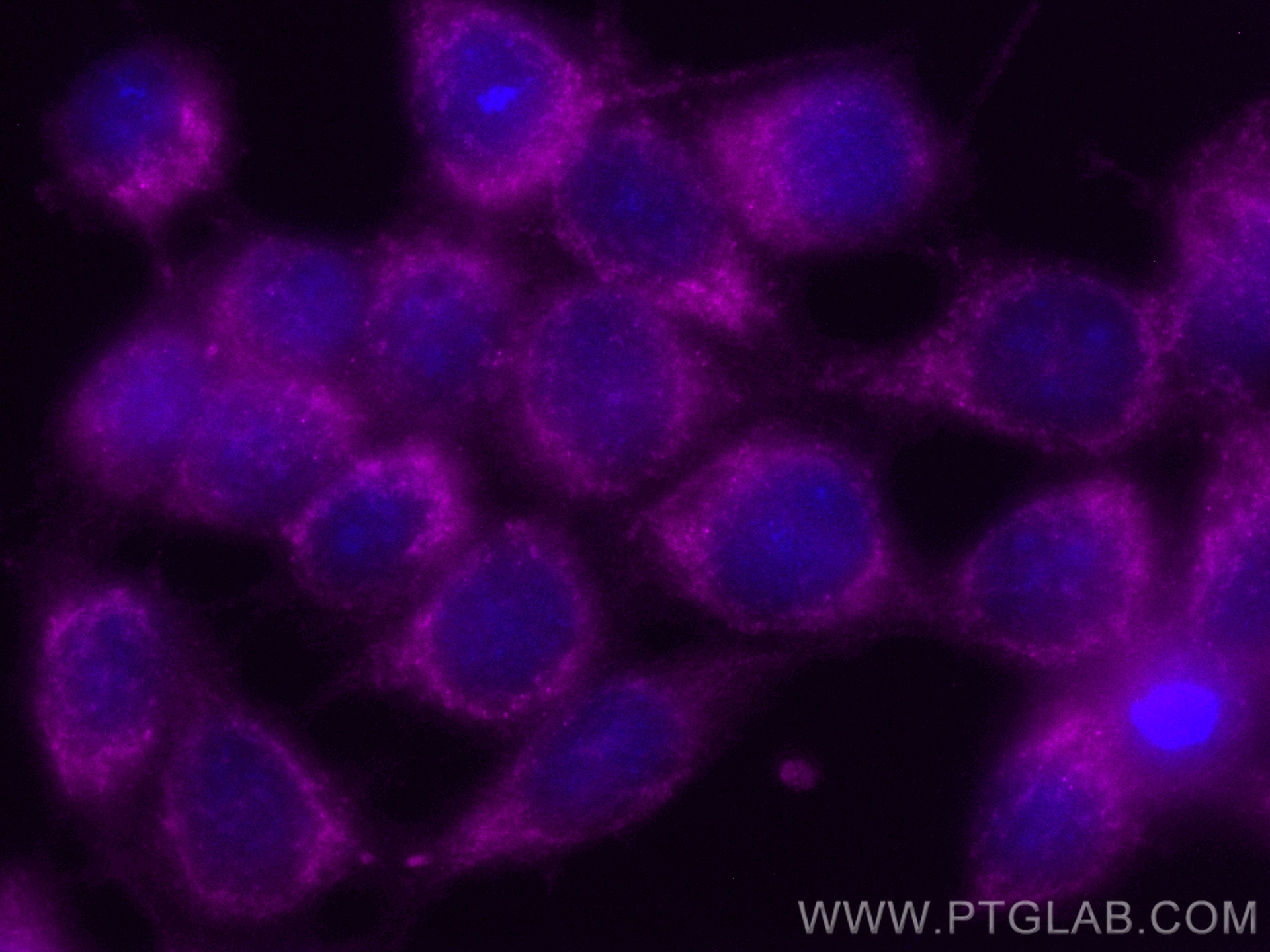 IF Staining of MCF-7 using CL647-10648