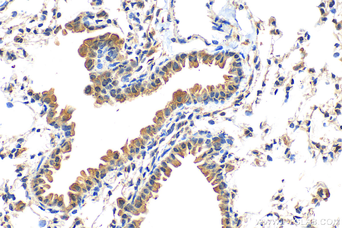 IHC staining of mouse lung using 13643-1-AP