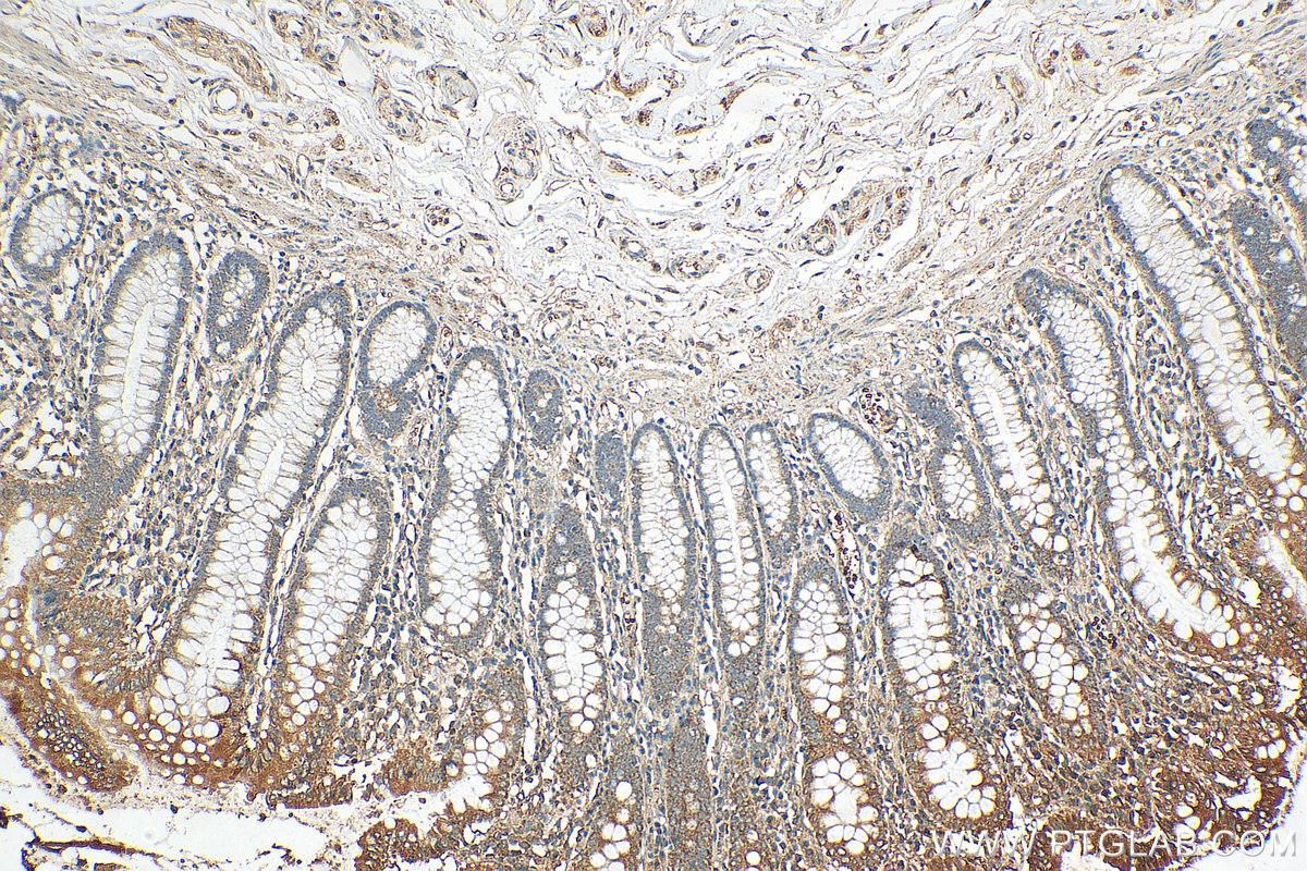 IHC staining of human colon using 29465-1-AP