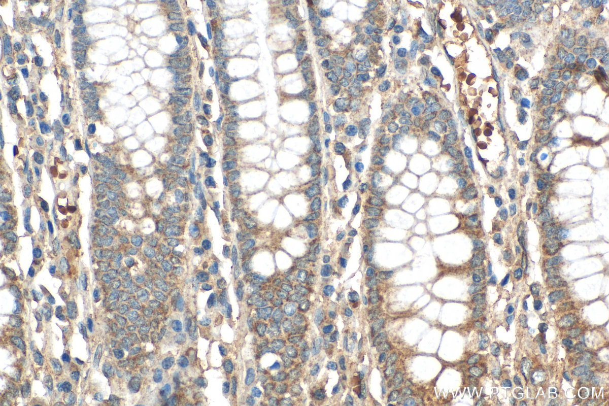 IHC staining of human colon using 29465-1-AP