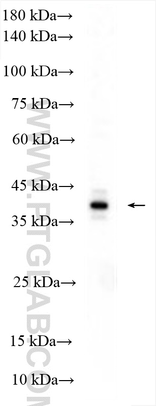 WB analysis of HEK-293T using 29465-1-AP