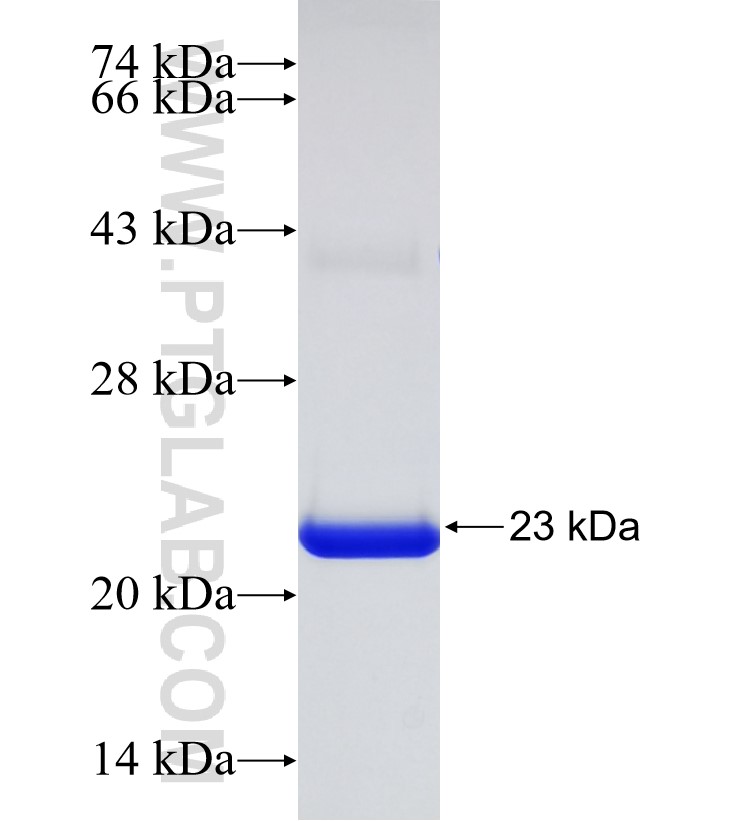ERAL1 fusion protein Ag30735 SDS-PAGE