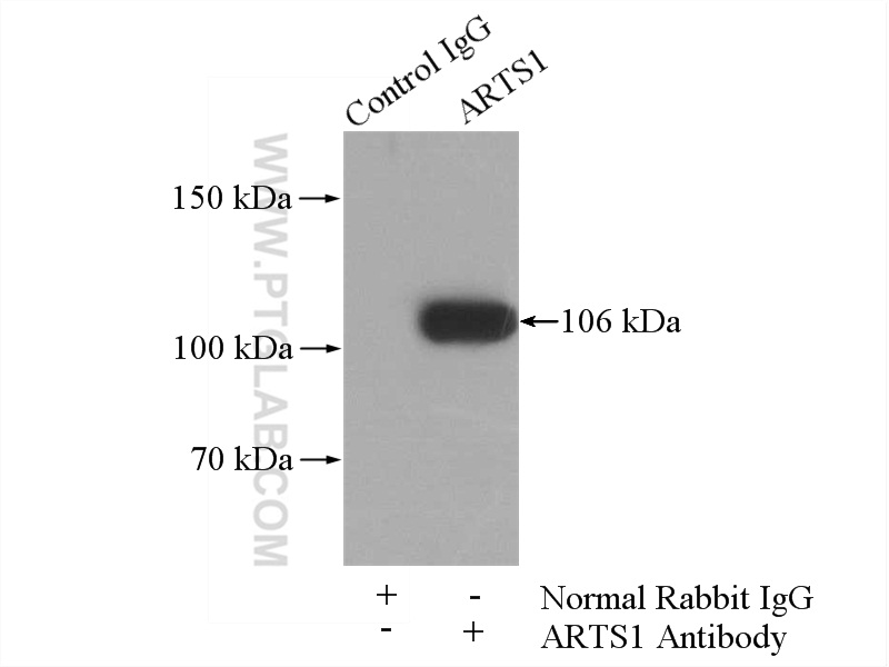 IP experiment of Jurkat using 13821-1-AP