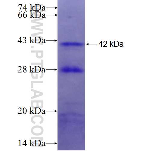 ERAP2 fusion protein Ag6351 SDS-PAGE ERAP2 fusion protein Ag6351 SDS-PAGE