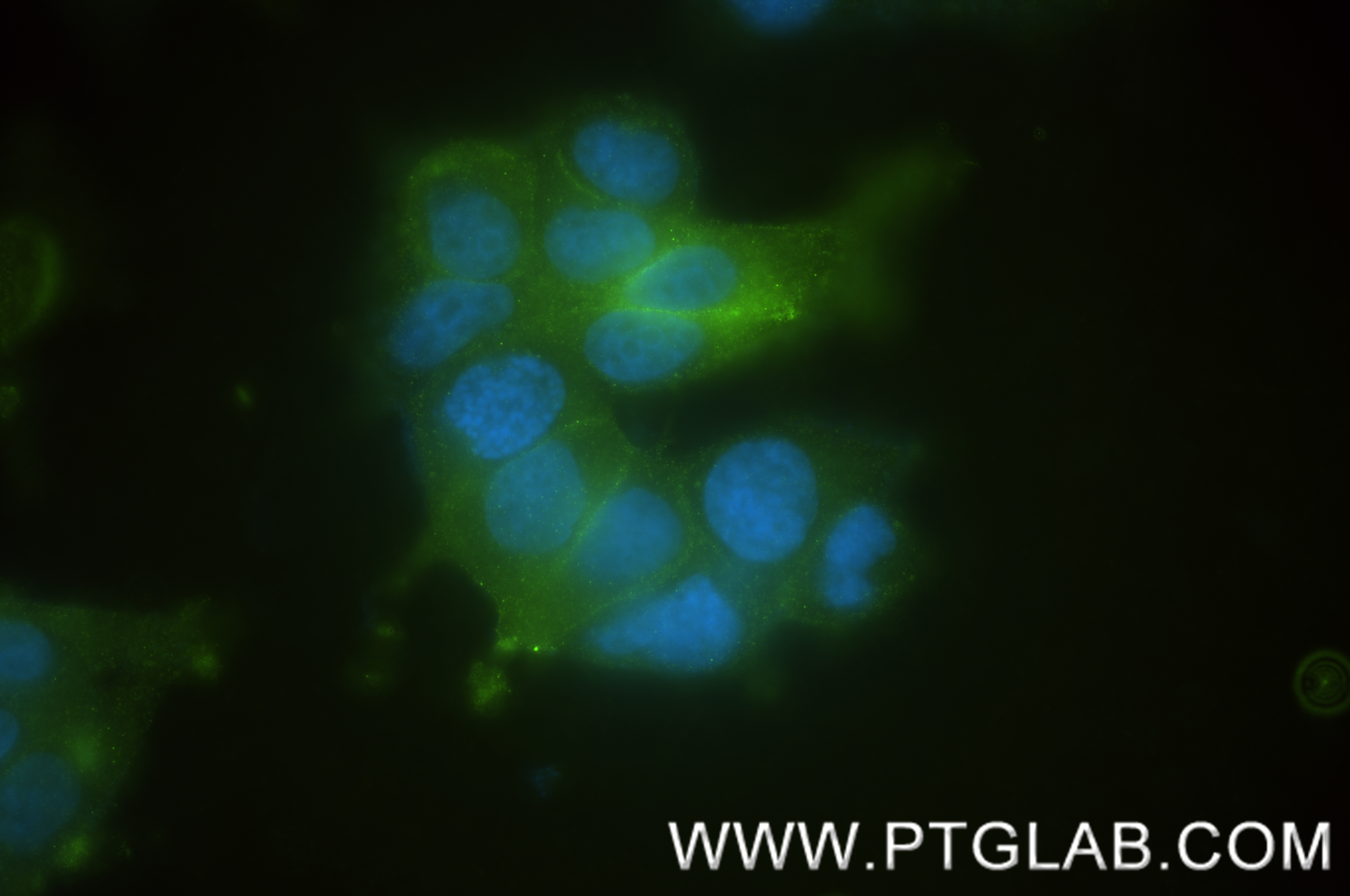 IF Staining of MCF-7 using 84046-1-RR (same clone as 84046-1-PBS)