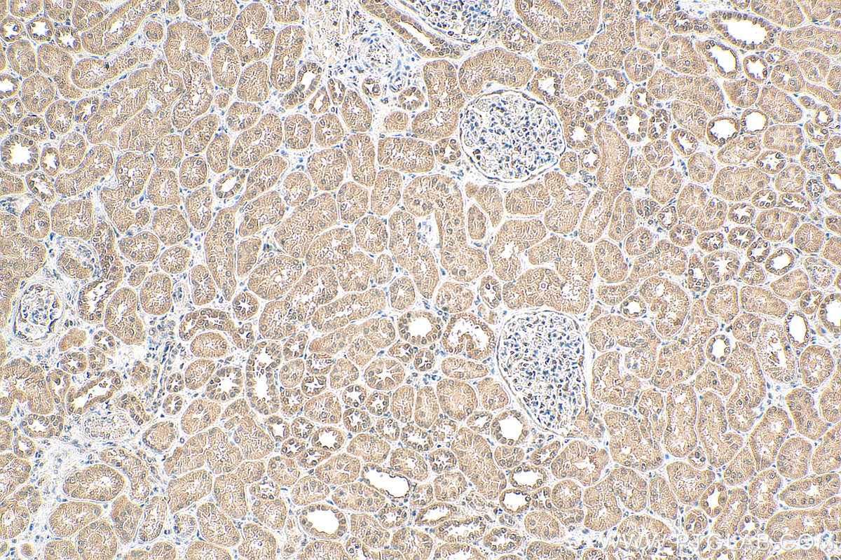 IHC staining of human kidney using 22438-1-AP