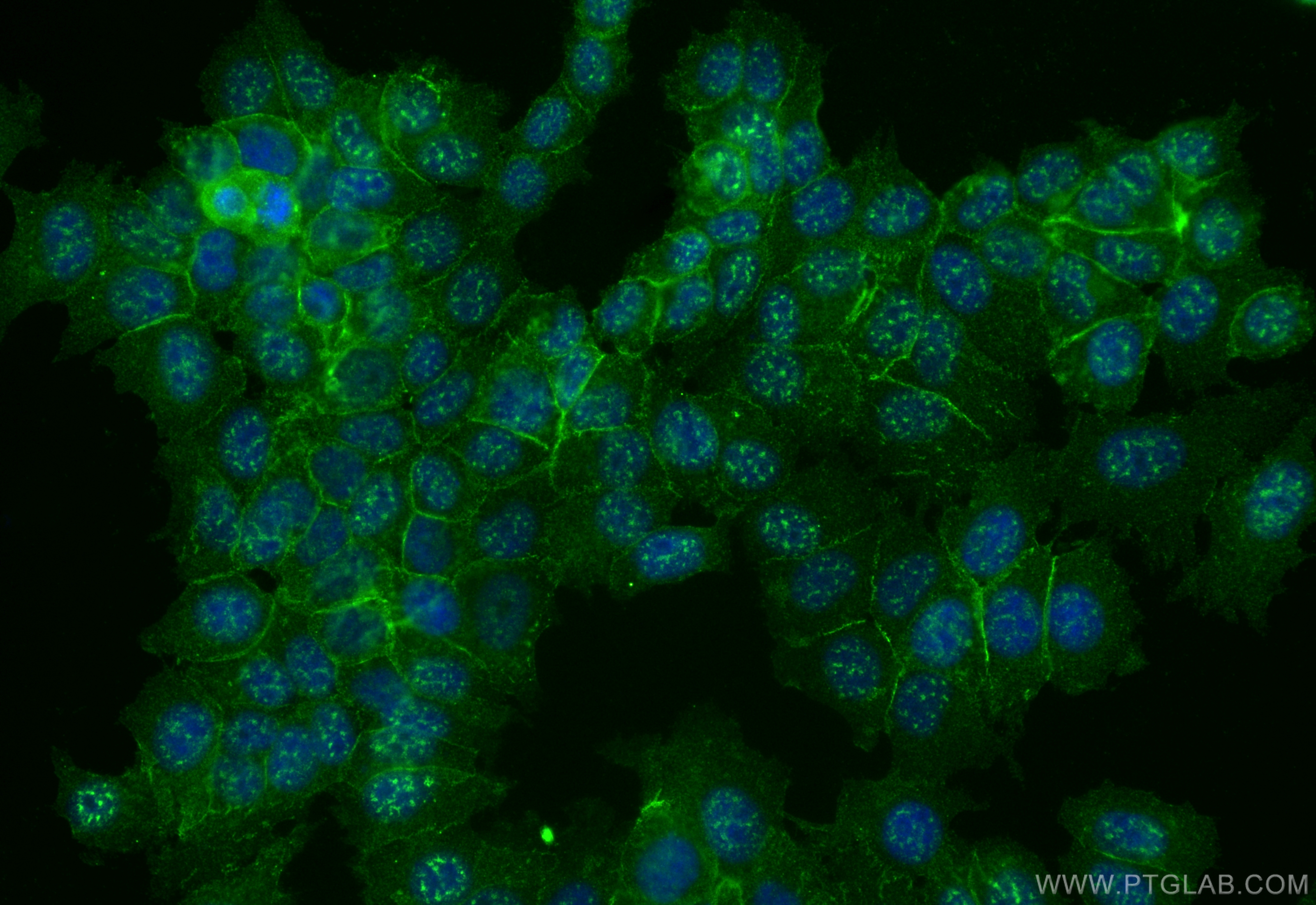 IF Staining of MCF-7 using 68159-1-Ig (same clone as 68159-1-PBS)