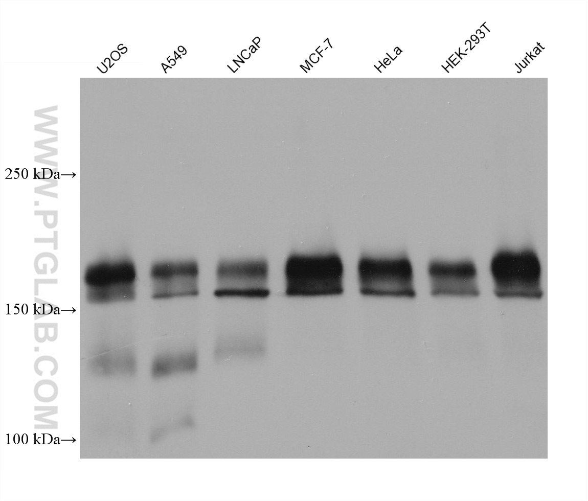 WB analysis using 68159-1-Ig (same clone as 68159-1-PBS)