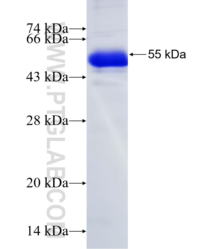ERBB2IP fusion protein Ag18514 SDS-PAGE