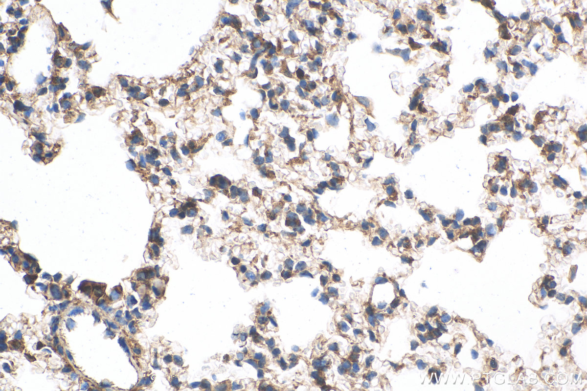 IHC staining of mouse lung using 19943-1-AP