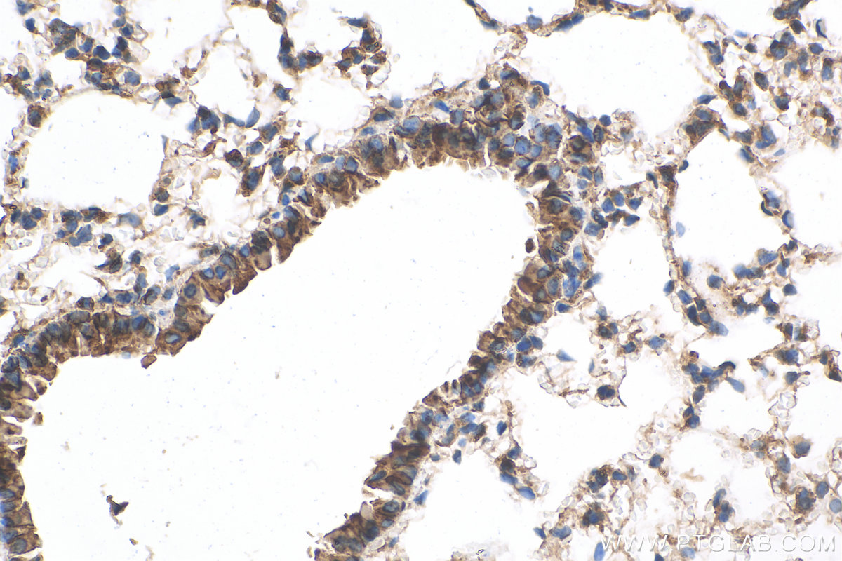 IHC staining of mouse lung using 19943-1-AP