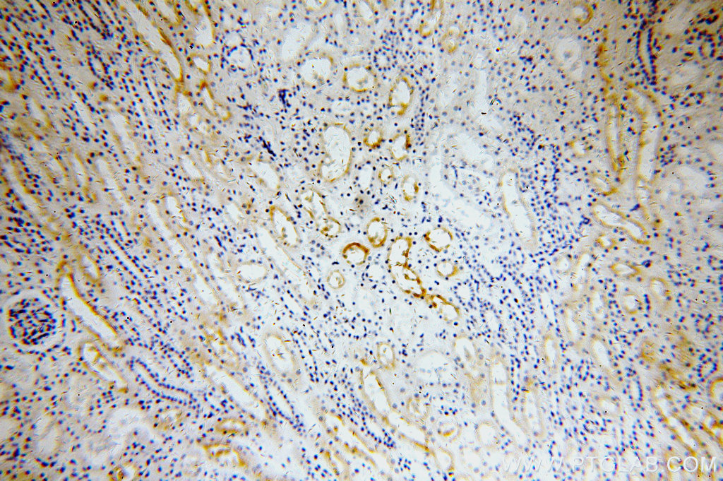 IHC staining of human kidney using 19943-1-AP