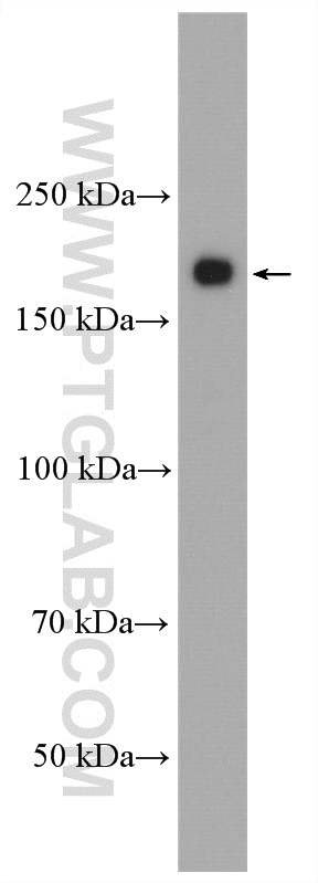 WB analysis of mouse brain using 19943-1-AP