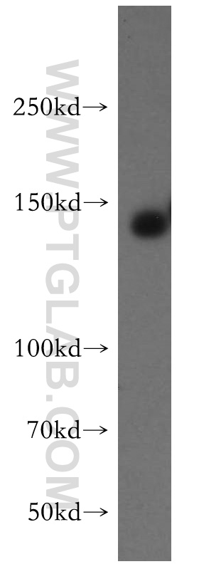 ERBB4 Polyclonal antibody