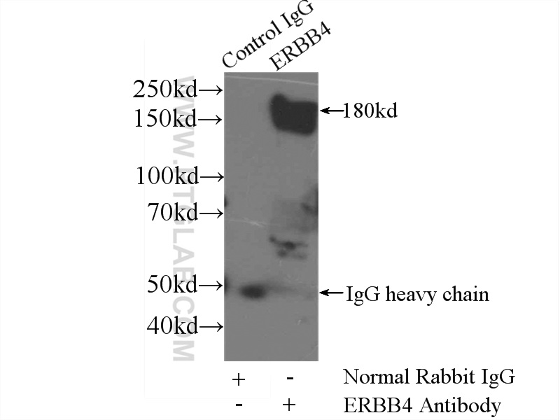 IP experiment of mouse brain using 22387-1-AP