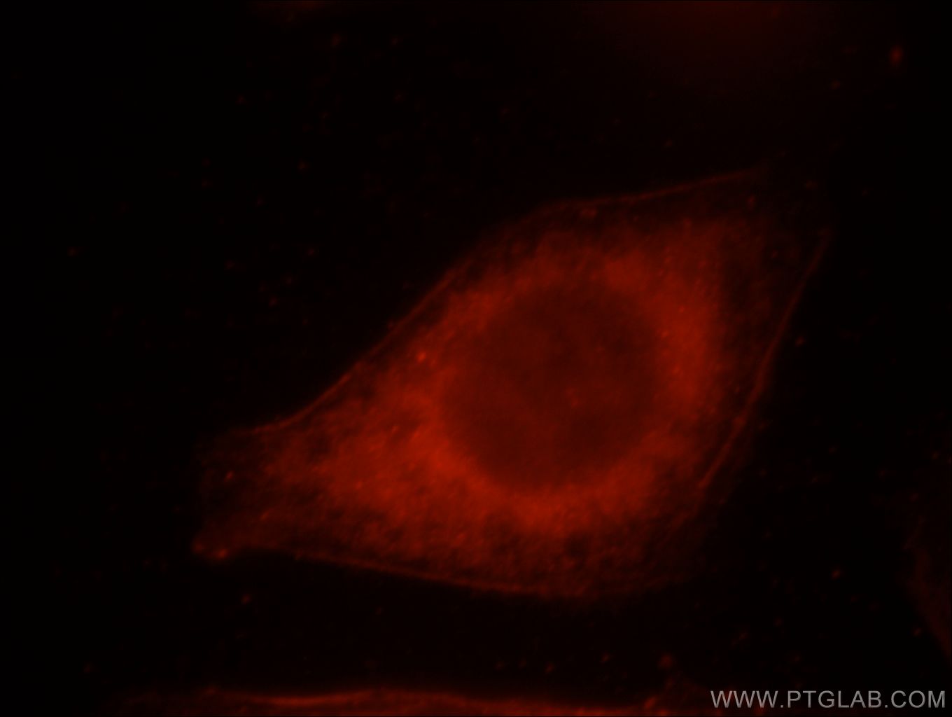 IF Staining of HeLa using 21396-1-AP