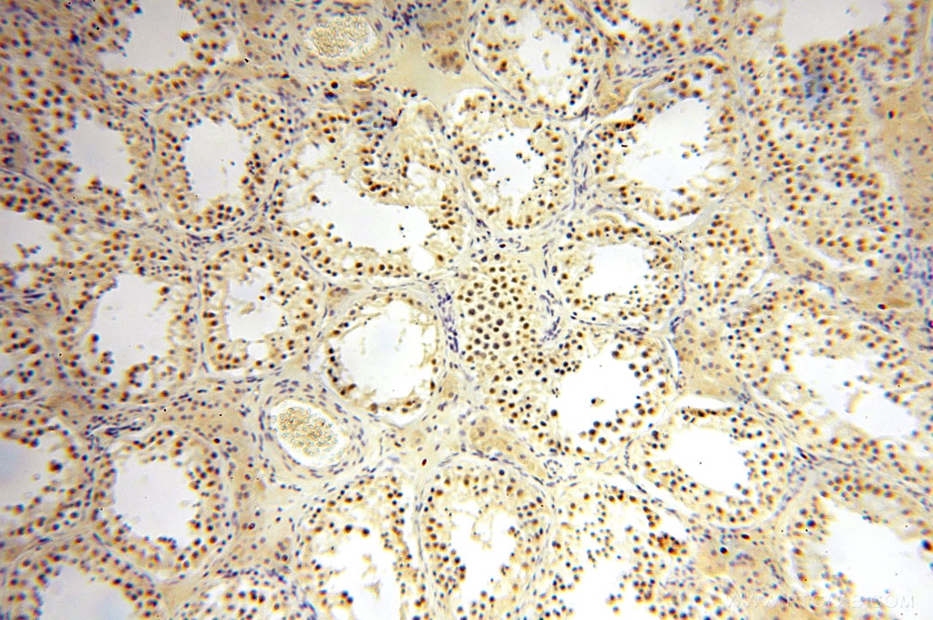 IHC staining of human testis using 14586-1-AP