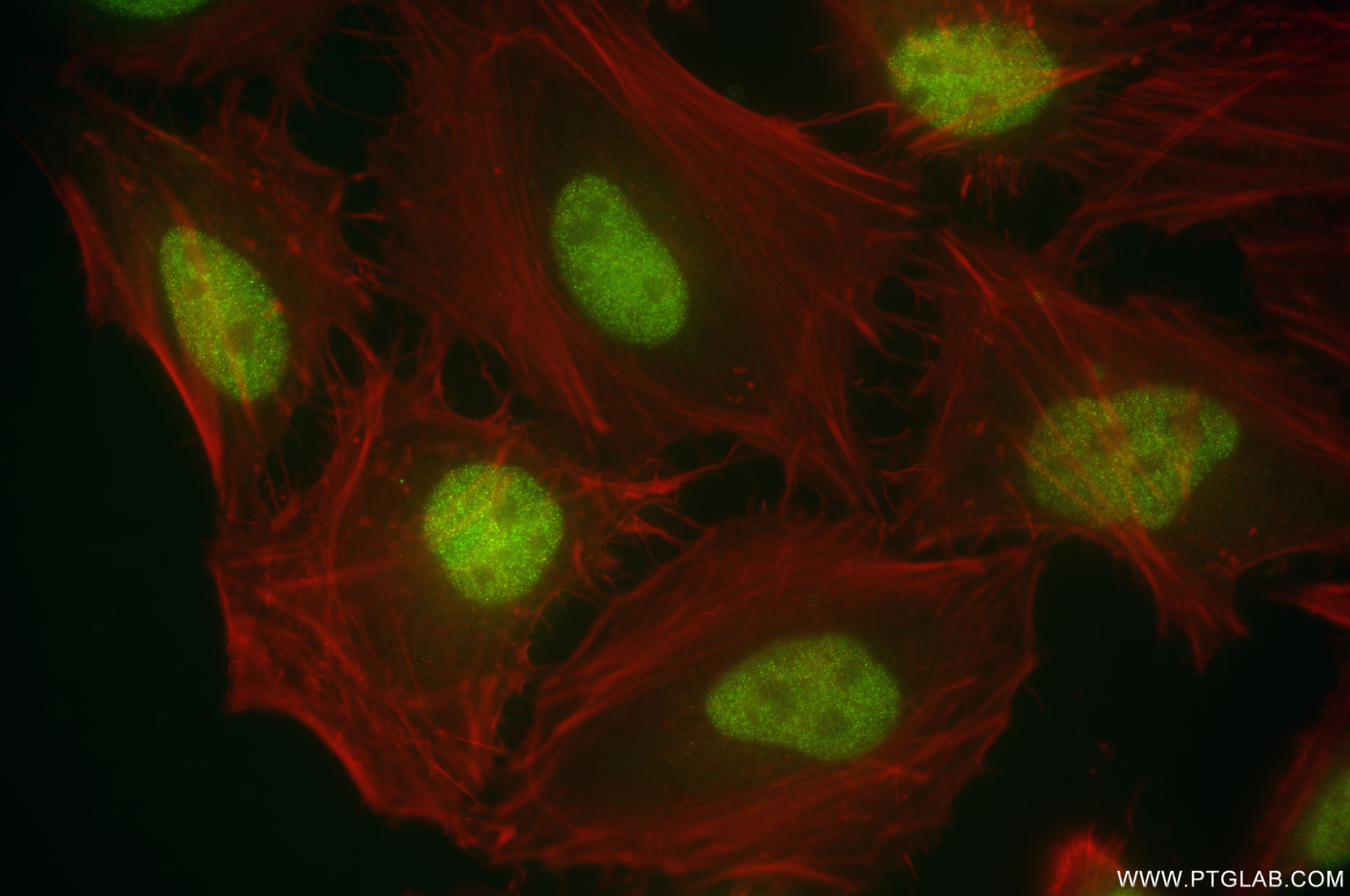 IF Staining of HeLa using 87175-3-RR (same clone as 87175-3-PBS) IF Staining of HeLa using 87175-3-RR (same clone as 87175-3-PBS)