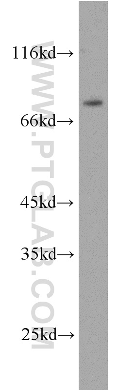 WB analysis of HeLa using 10818-1-AP