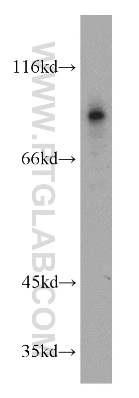 WB analysis of HEK-293 using 10580-1-AP