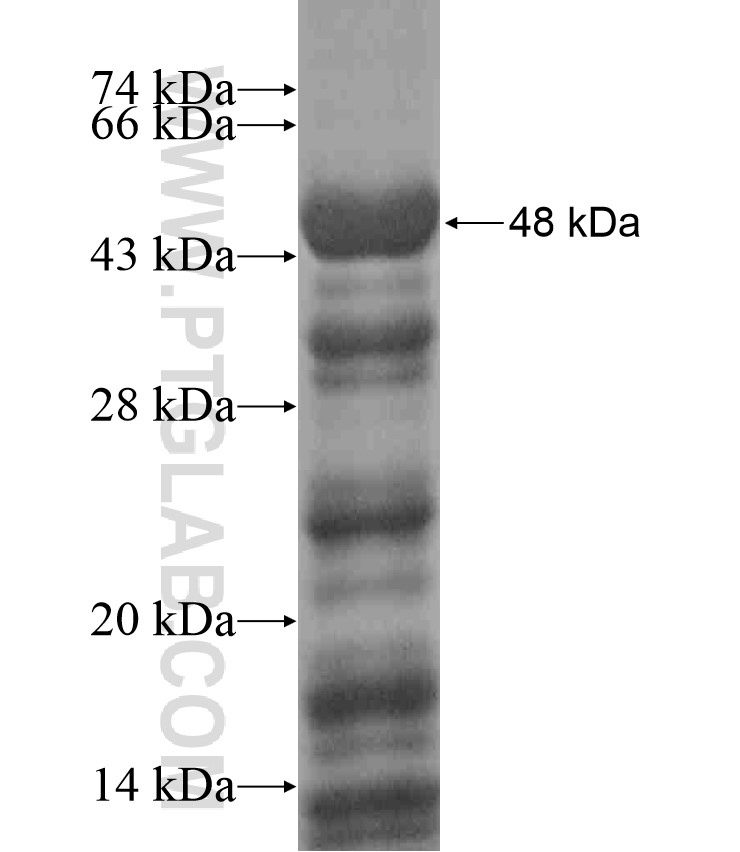ERCC6 fusion protein Ag18260 SDS-PAGE ERCC6 fusion protein Ag18260 SDS-PAGE