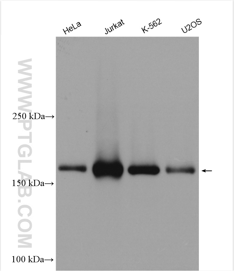 WB analysis using 15688-1-AP