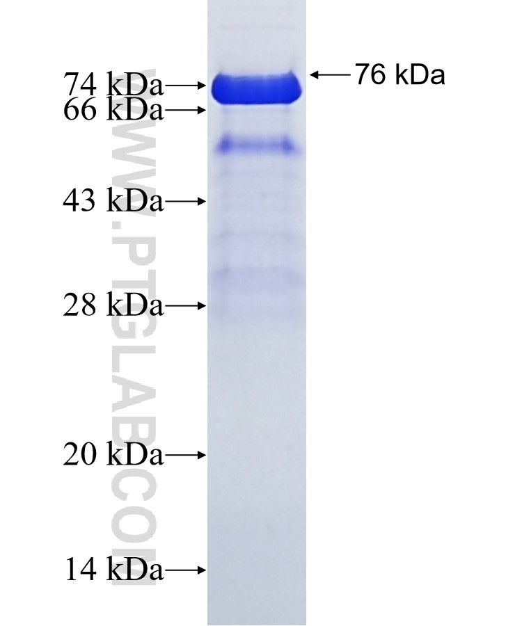 ERCC6L fusion protein Ag8223 SDS-PAGE