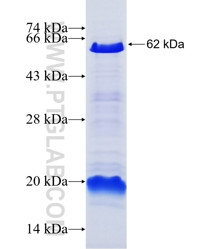 ERCC6L fusion protein Ag8238 SDS-PAGE ERCC6L fusion protein Ag8238 SDS-PAGE