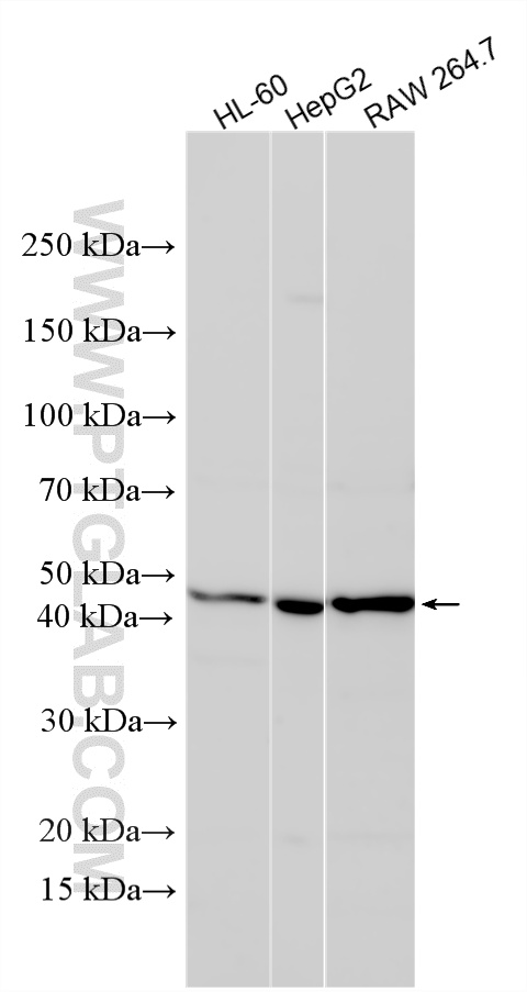 Various lysates were subjected to SDS PAGE followed by western blot with 15921-1-AP (ERCC8 antibody) at dilution of 1:800 incubated at room temperature for 1.5 hours. WB analysis using 15921-1-AP