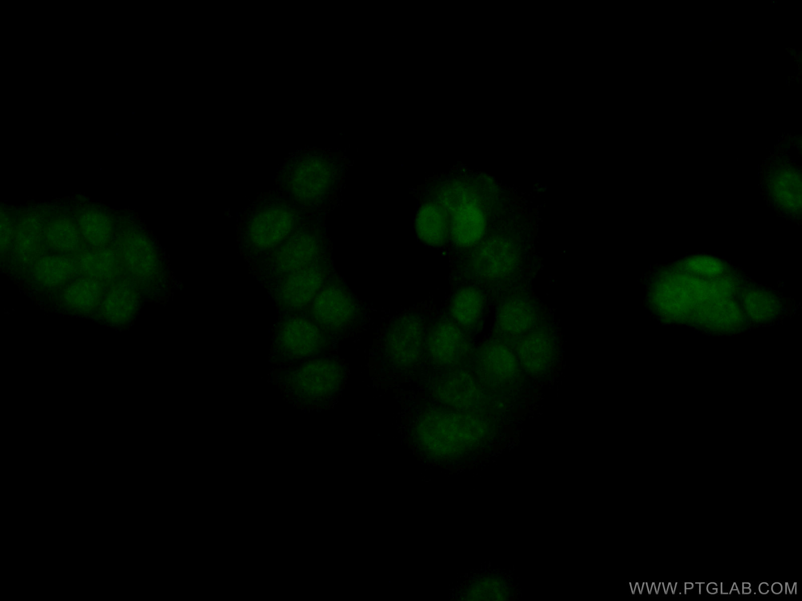 IF Staining of MCF-7 using 14356-1-AP