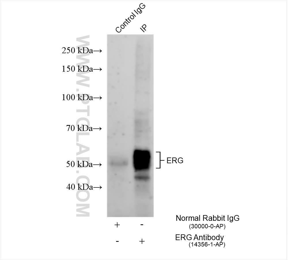 IP experiment of rat heart using 14356-1-AP