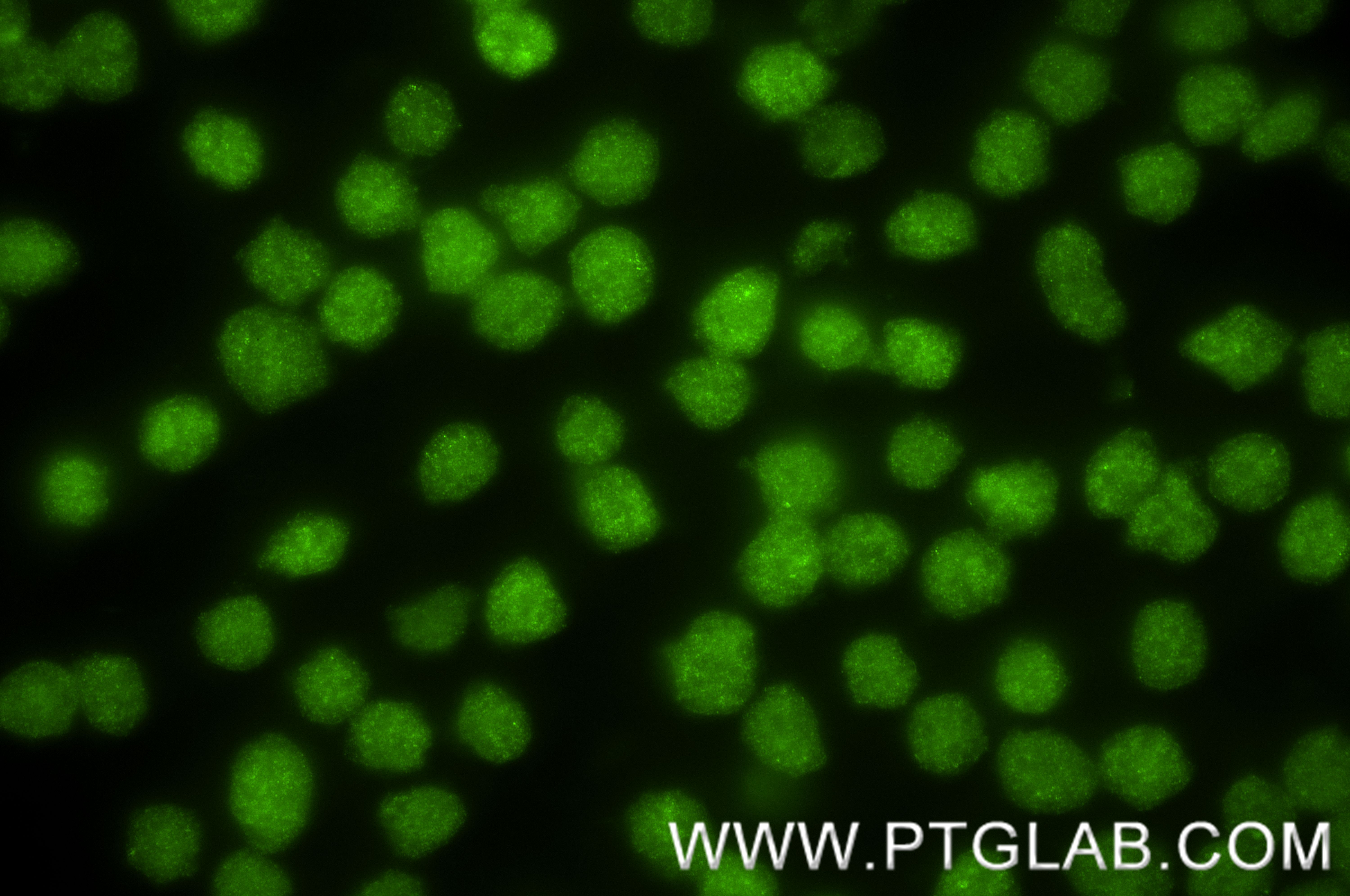IF Staining of MOLT-4 using 88009-1-RR (same clone as 88009-1-PBS)