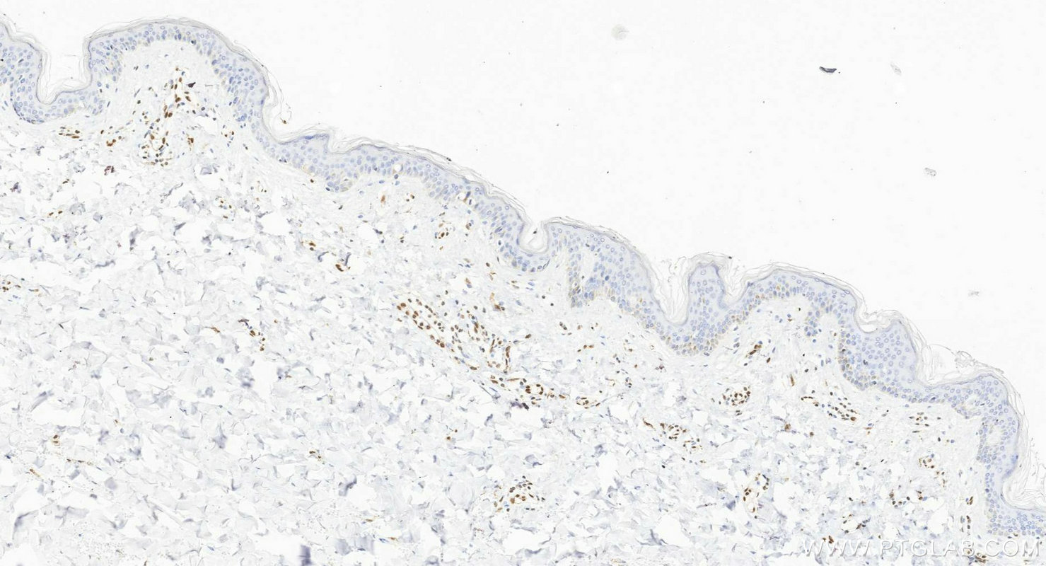 IHC staining of human skin using 88009-1-RR (same clone as 88009-1-PBS) IHC staining of human skin using 88009-1-RR (same clone as 88009-1-PBS)
