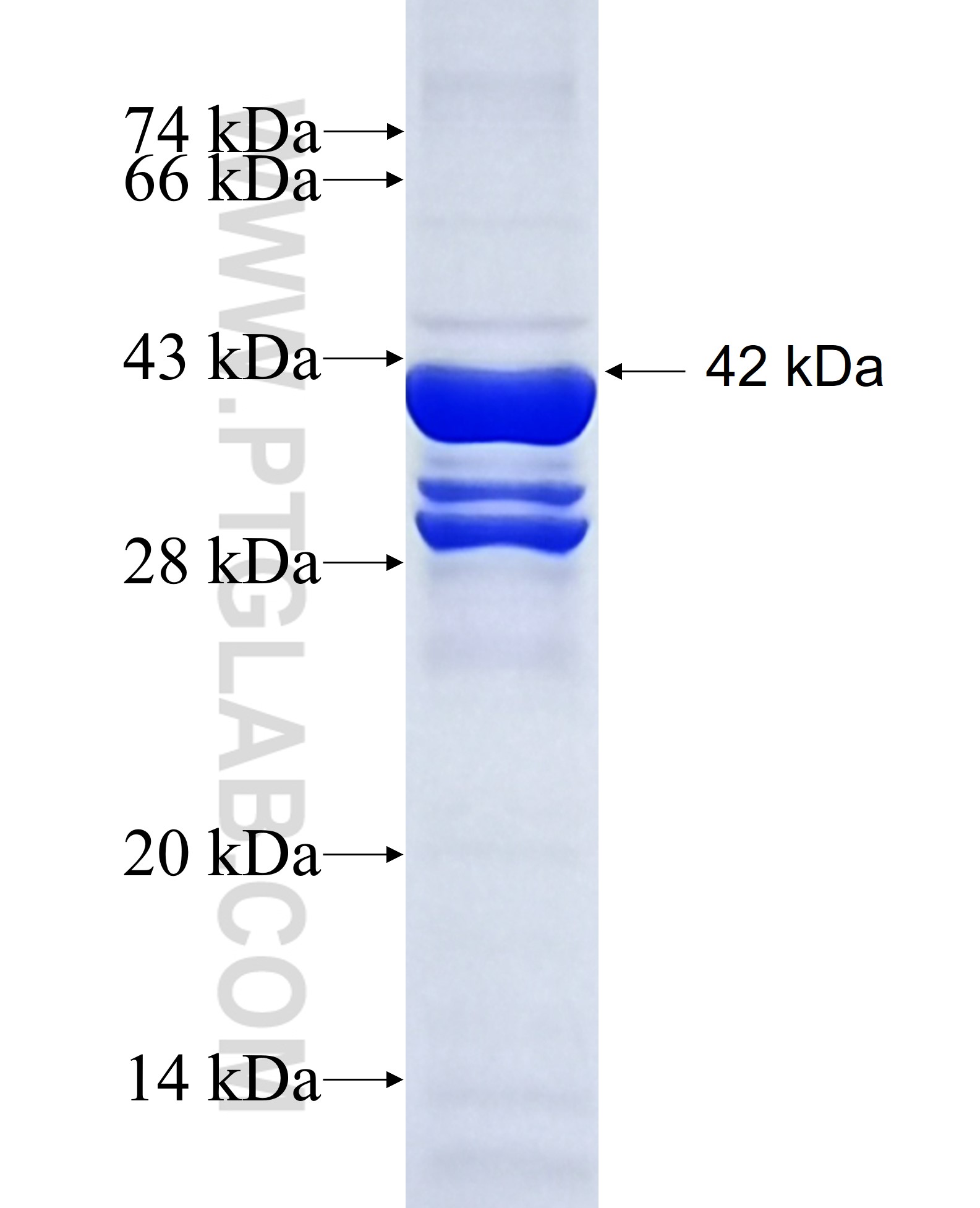 ERG fusion protein Ag5708 SDS-PAGE