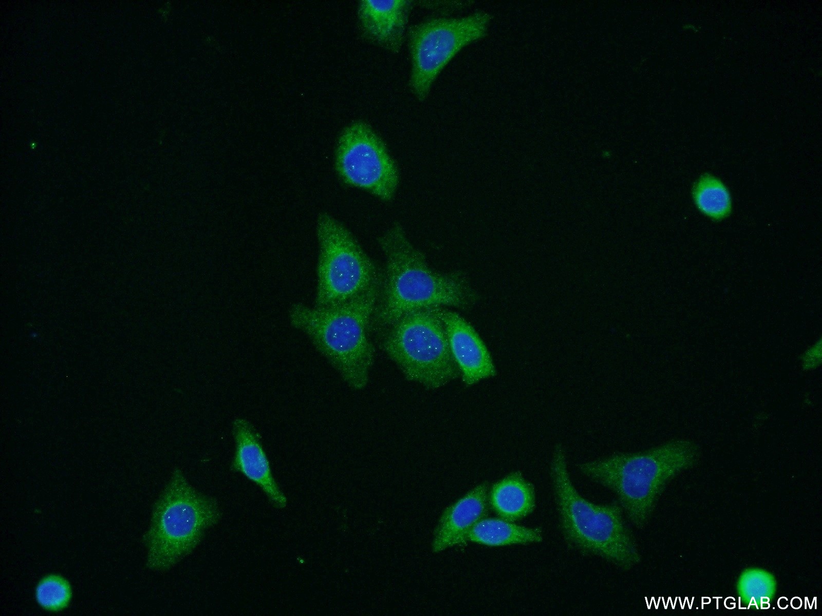 IF Staining of HepG2 using 16108-1-AP