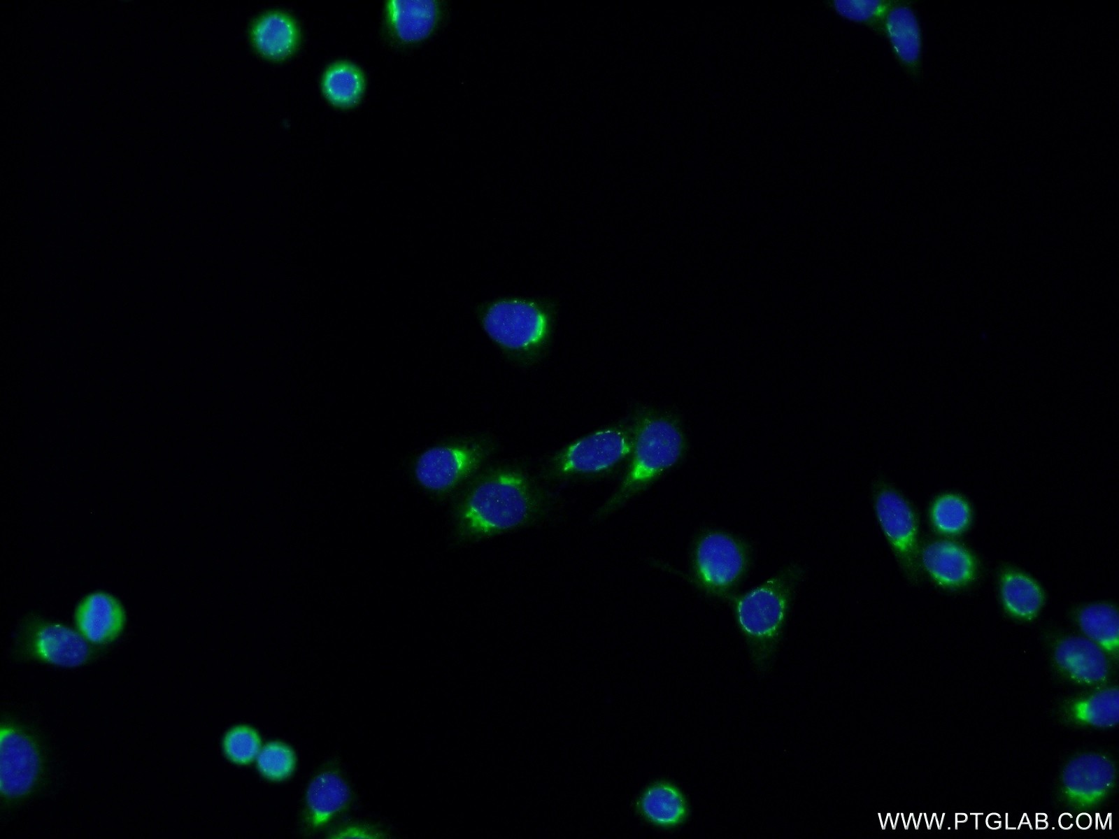 IF Staining of HepG2 using 16029-1-AP