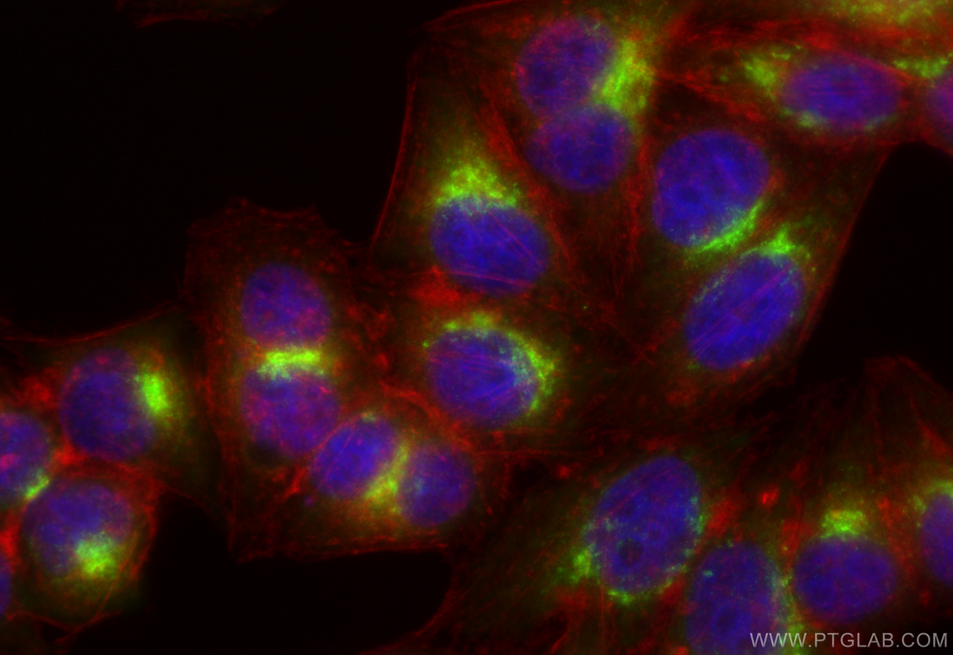 IF Staining of HepG2 using 16029-1-AP