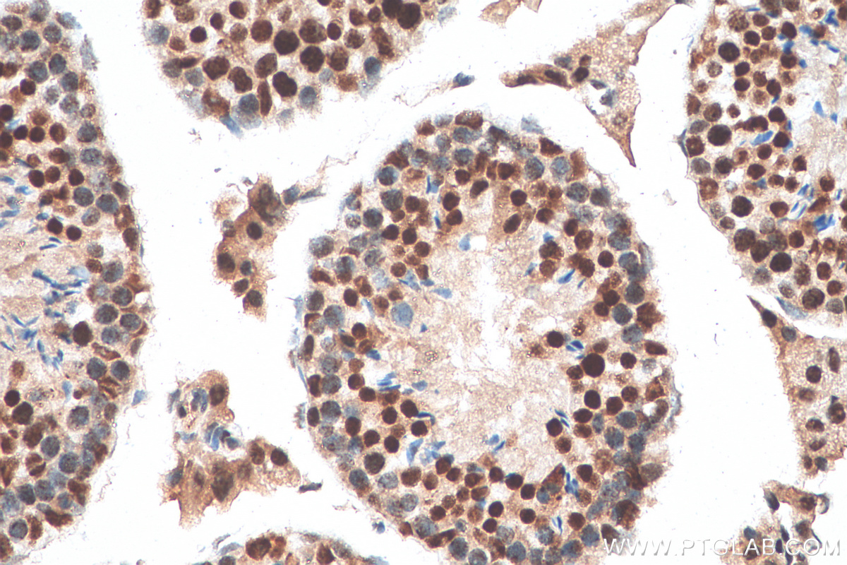 IHC staining of mouse testis using 15974-1-AP