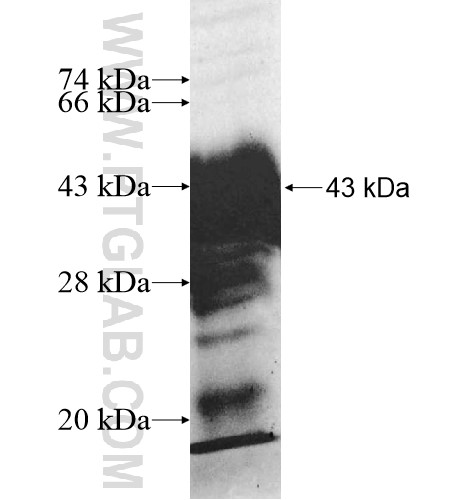 ERI2 fusion protein Ag11156 SDS-PAGE ERI2 fusion protein Ag11156 SDS-PAGE