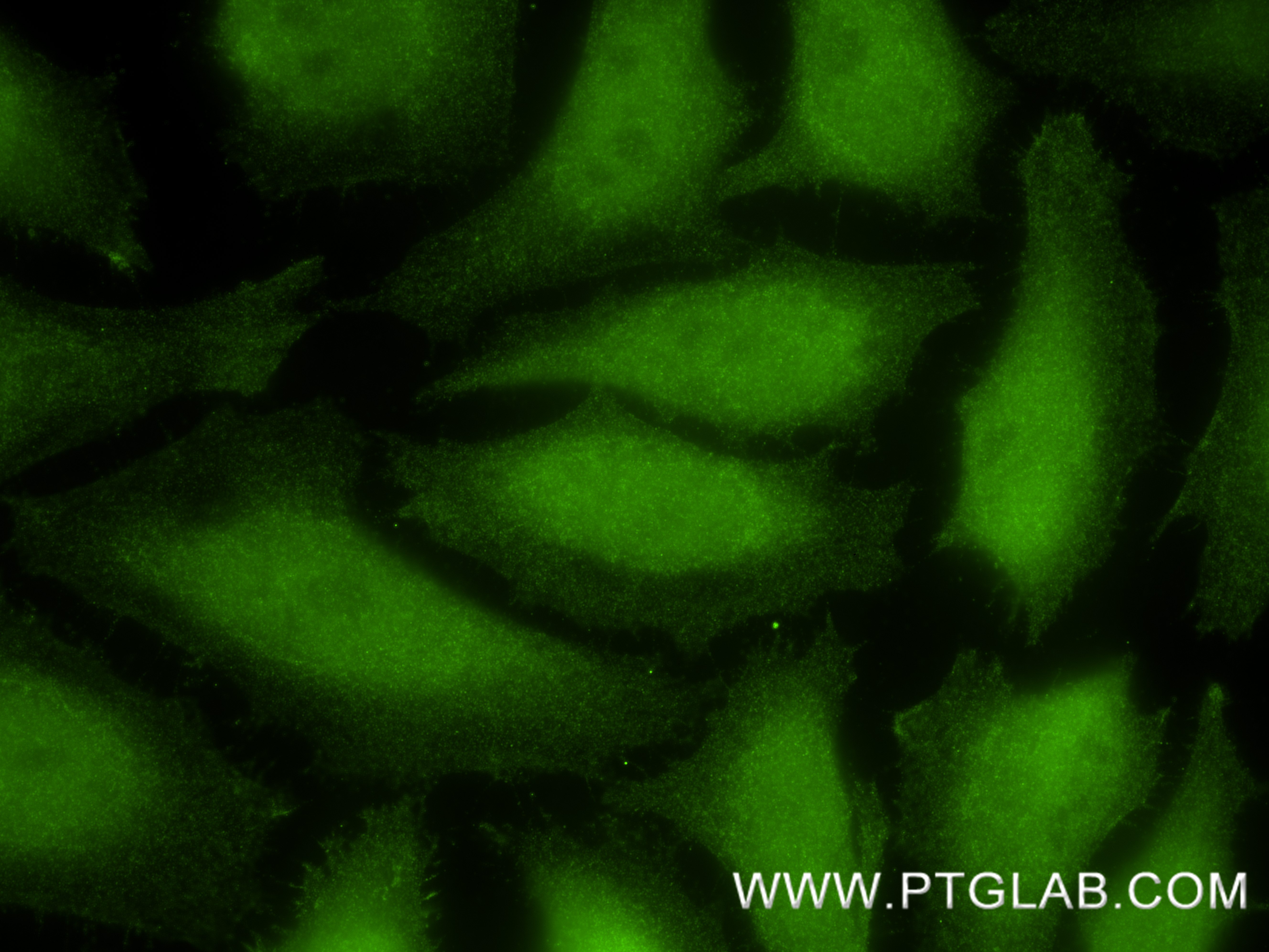 IF Staining of HeLa using 83533-1-RR (same clone as 83533-1-PBS) IF Staining of HeLa using 83533-1-RR (same clone as 83533-1-PBS)