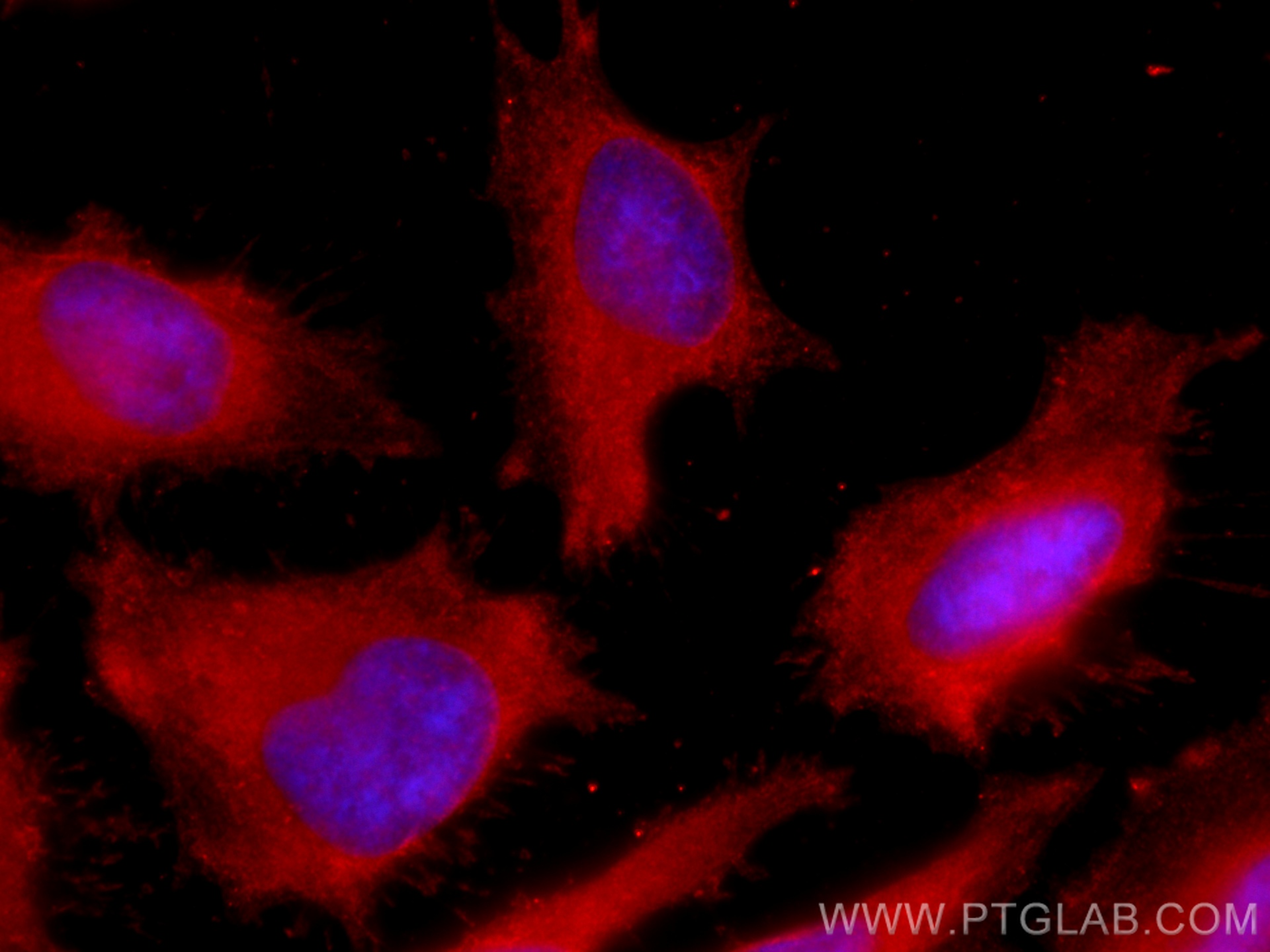 IF Staining of HeLa using CL594-66192