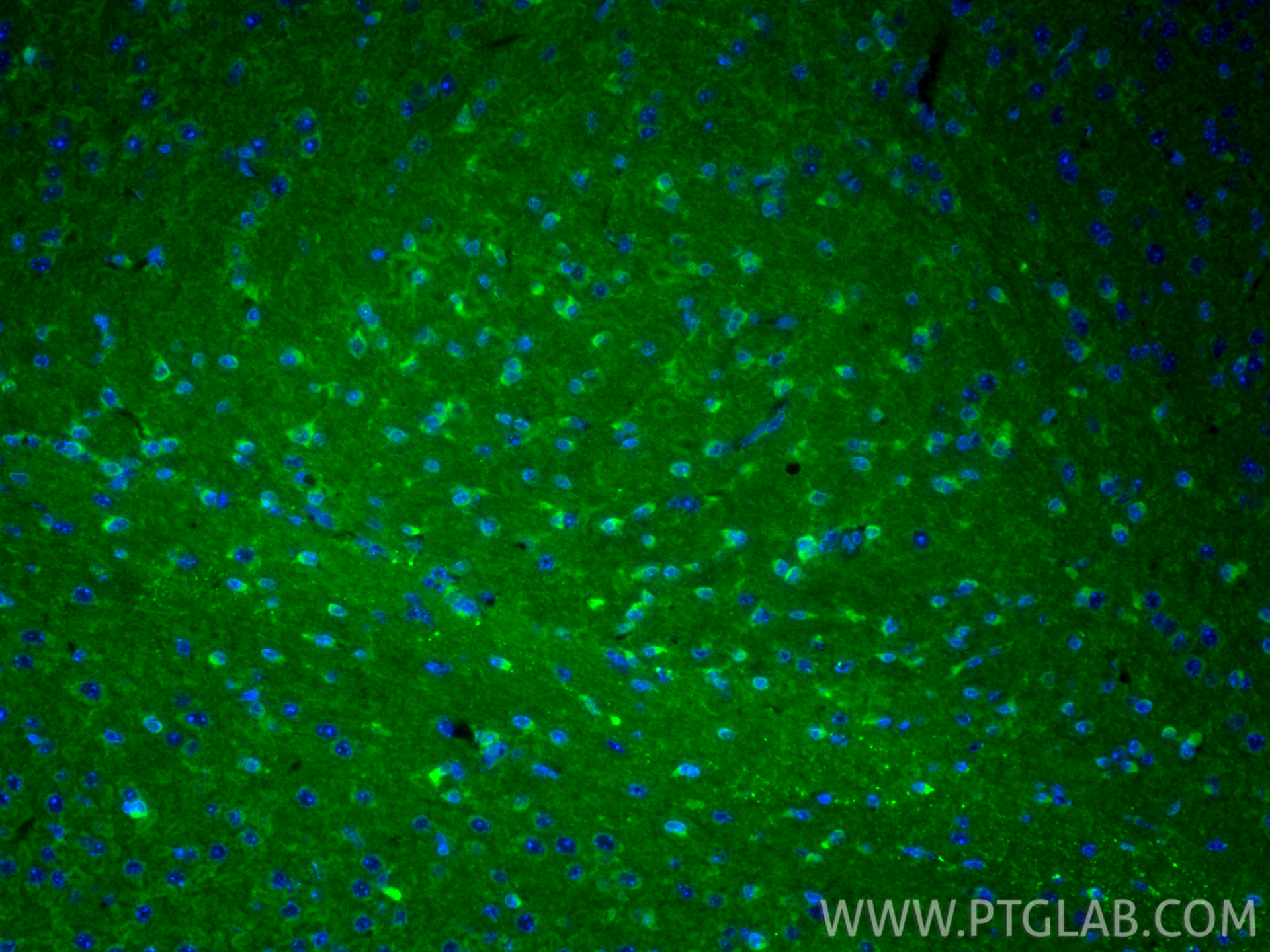 IF Staining of mouse brain using 11257-1-AP IF Staining of mouse brain using 11257-1-AP