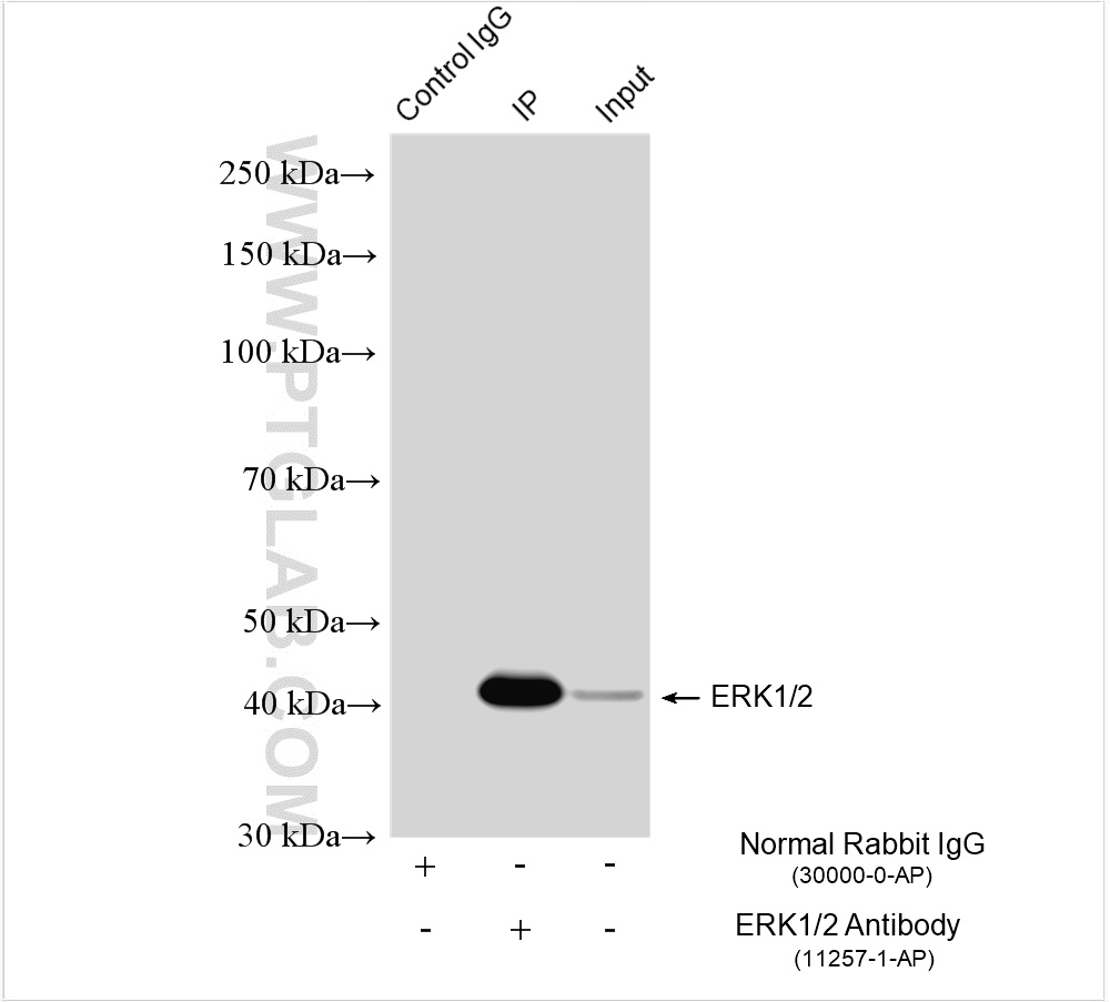 IP experiment of HEK-293 using 11257-1-AP