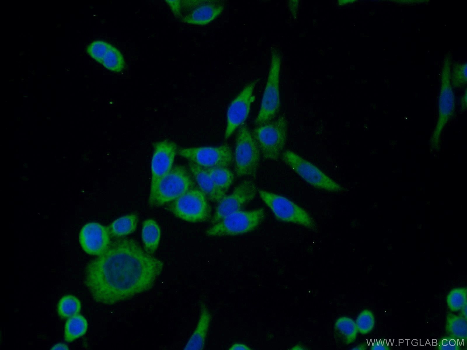 IF Staining of HeLa using 16443-1-AP