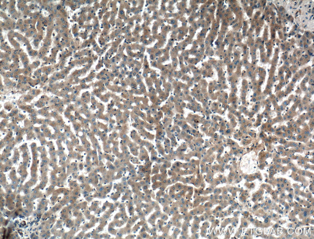 IHC staining of human liver using 16443-1-AP